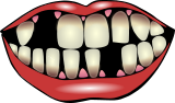 Vektorový obrázek, ilustrační klipart Zkažené zuby ke stažení, Ostatní vektorový obrázek pro vaše dokumenty